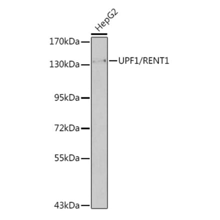 Western Blot - Anti-UPF1 Antibody (A92778) - Antibodies.com