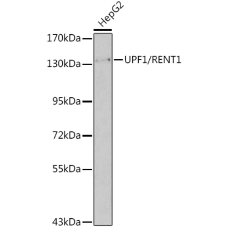 Western Blot - Anti-UPF1 Antibody (A92778) - Antibodies.com