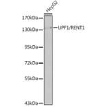 Western Blot - Anti-UPF1 Antibody (A92778) - Antibodies.com