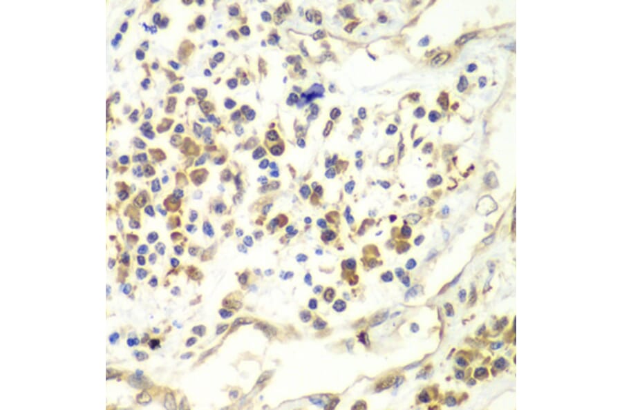 Immunohistochemistry - Anti-UPF1 Antibody (A92778) - Antibodies.com