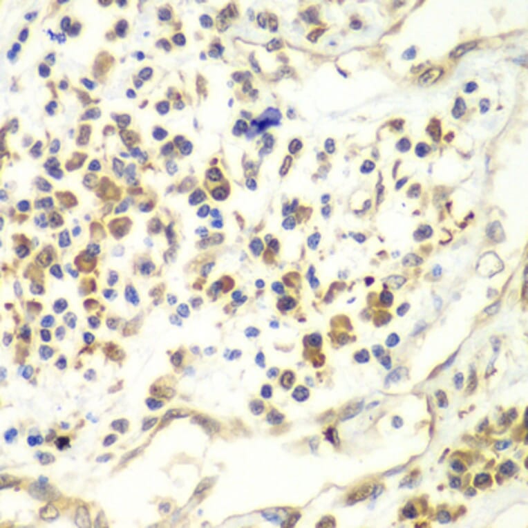 Immunohistochemistry - Anti-UPF1 Antibody (A92778) - Antibodies.com