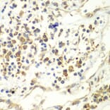 Immunohistochemistry - Anti-UPF1 Antibody (A92778) - Antibodies.com