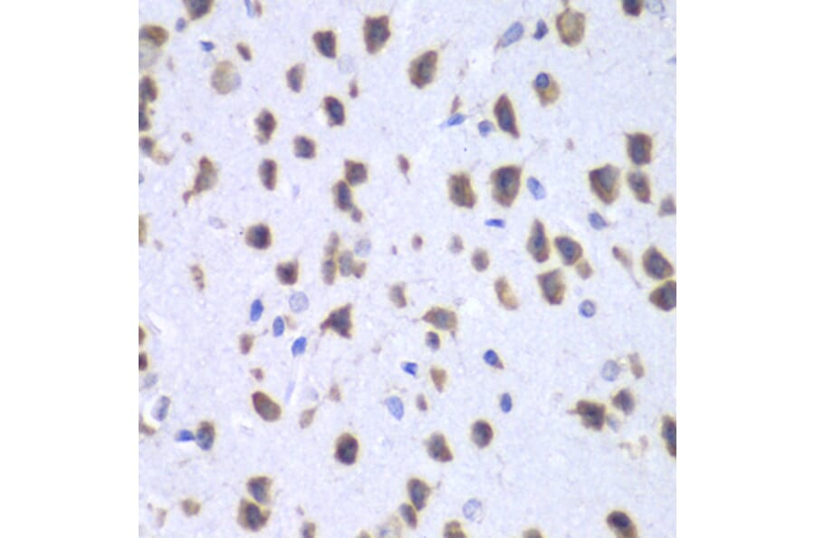 Immunohistochemistry - Anti-UPF1 Antibody (A92778) - Antibodies.com