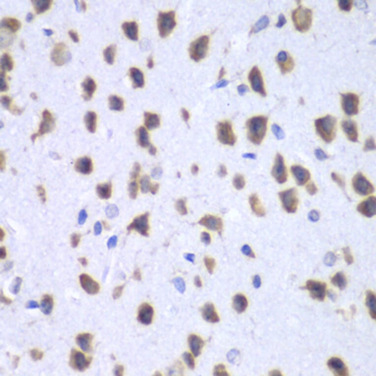 Immunohistochemistry - Anti-UPF1 Antibody (A92778) - Antibodies.com