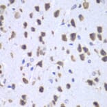 Immunohistochemistry - Anti-UPF1 Antibody (A92778) - Antibodies.com