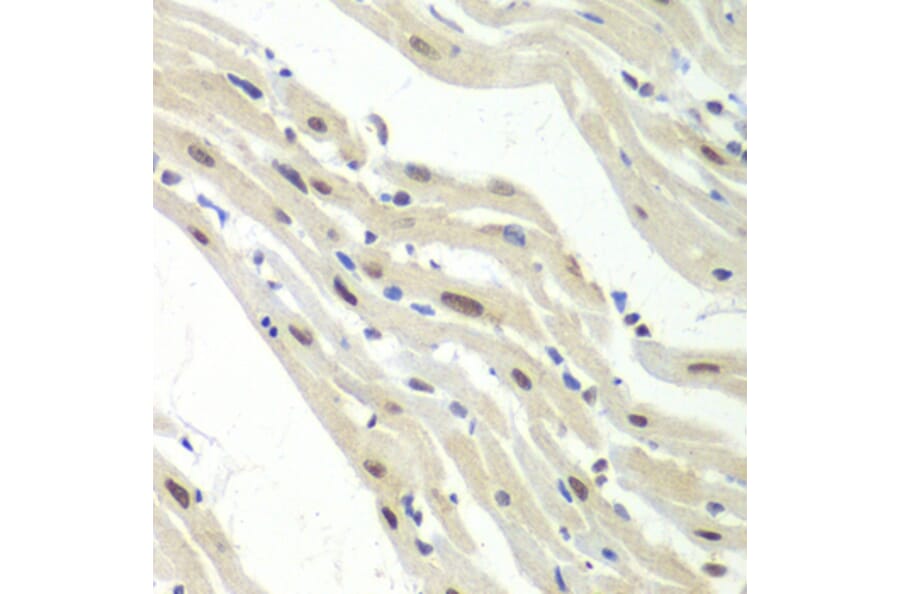 Immunohistochemistry - Anti-UPF1 Antibody (A92778) - Antibodies.com