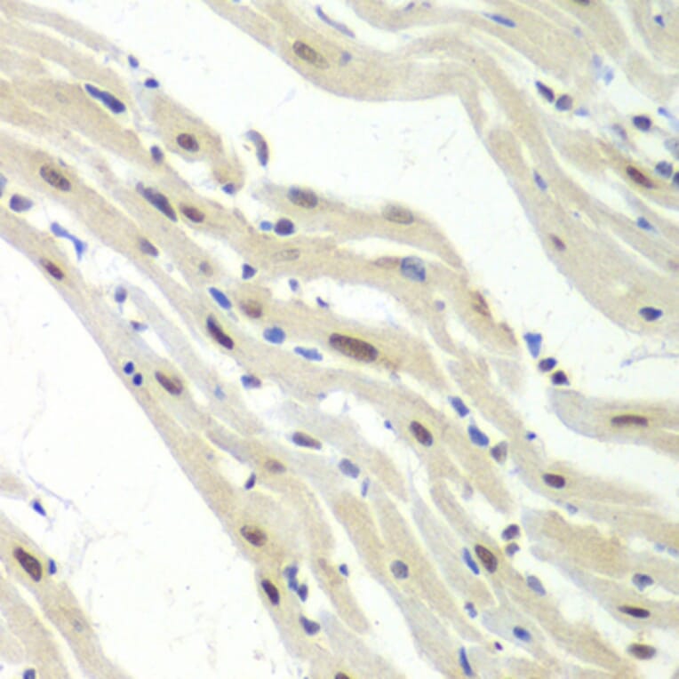 Immunohistochemistry - Anti-UPF1 Antibody (A92778) - Antibodies.com