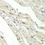 Immunohistochemistry - Anti-UPF1 Antibody (A92778) - Antibodies.com