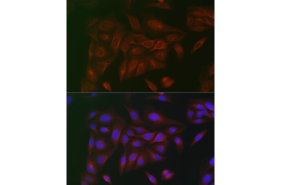 Immunofluorescence - Anti-CD130 Antibody (A92779) - Antibodies.com