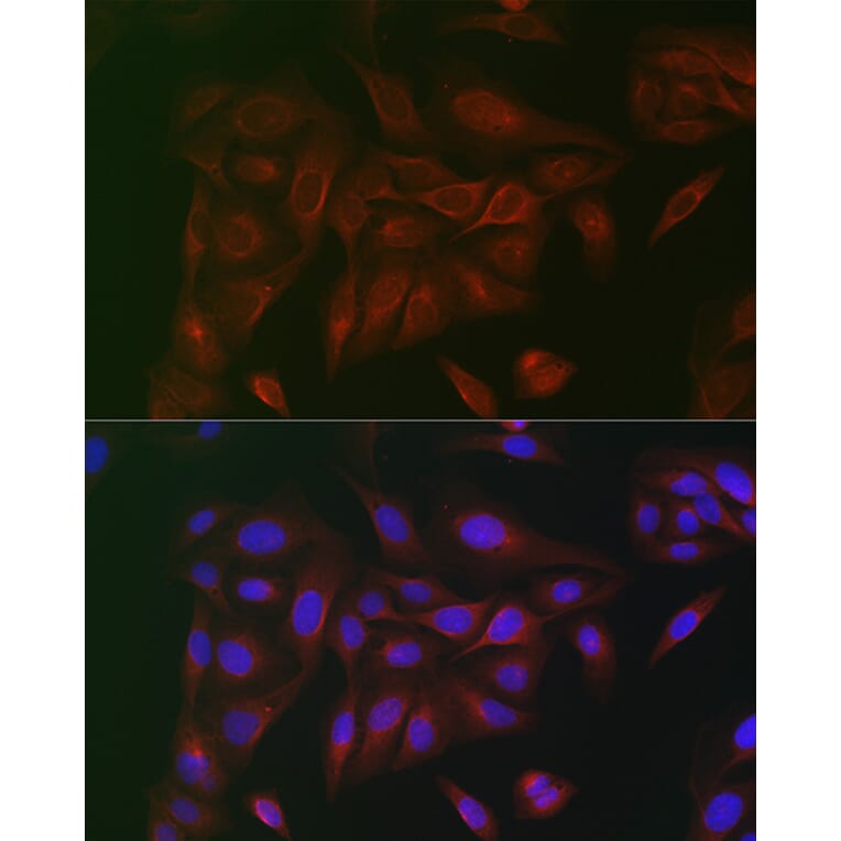 Immunofluorescence - Anti-CD130 Antibody (A92779) - Antibodies.com