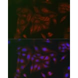 Immunofluorescence - Anti-CD130 Antibody (A92779) - Antibodies.com