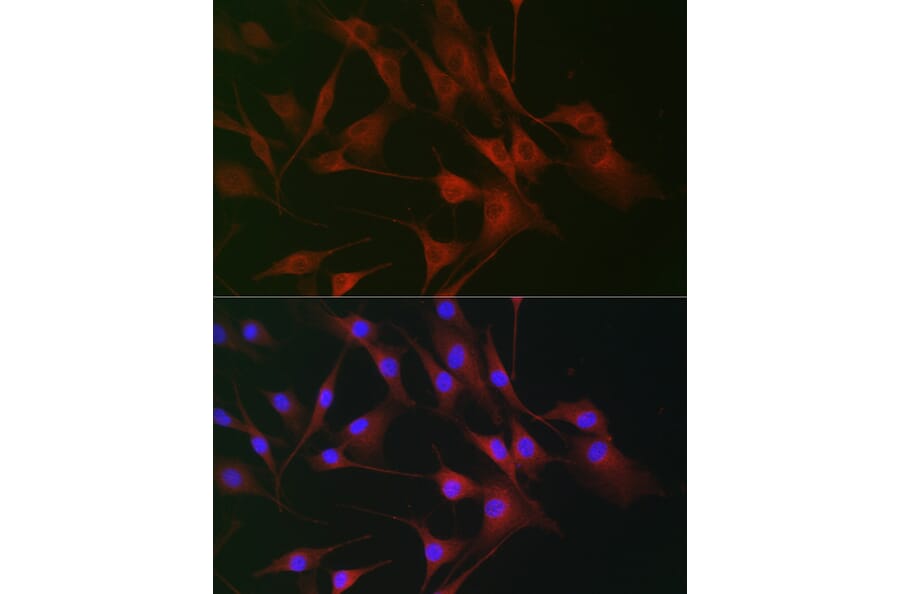 Immunofluorescence - Anti-CD130 Antibody (A92779) - Antibodies.com