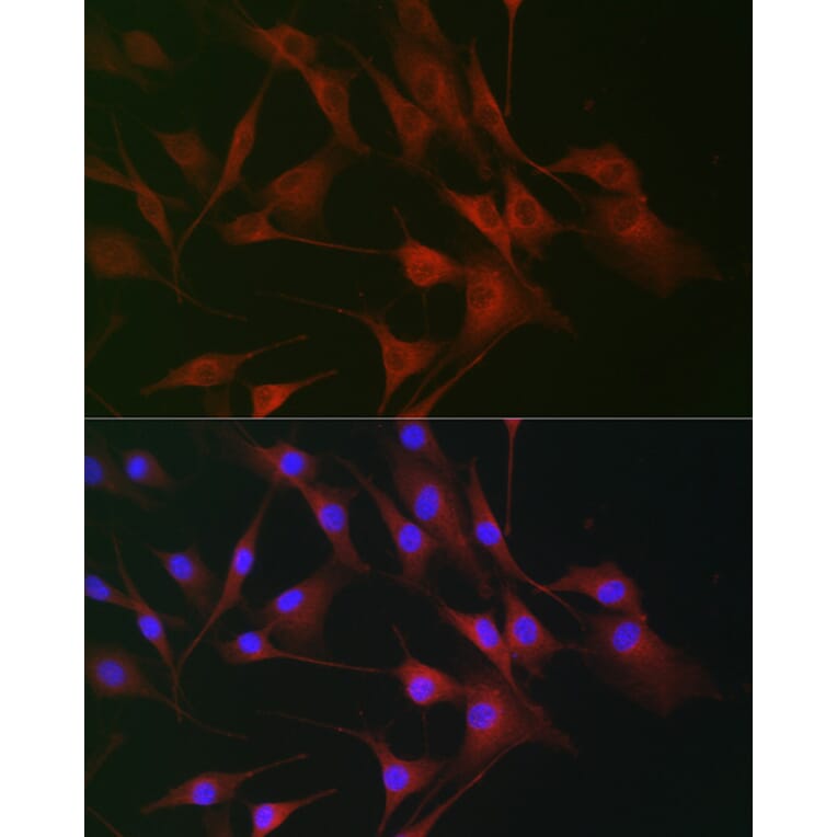 Immunofluorescence - Anti-CD130 Antibody (A92779) - Antibodies.com