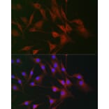 Immunofluorescence - Anti-CD130 Antibody (A92779) - Antibodies.com
