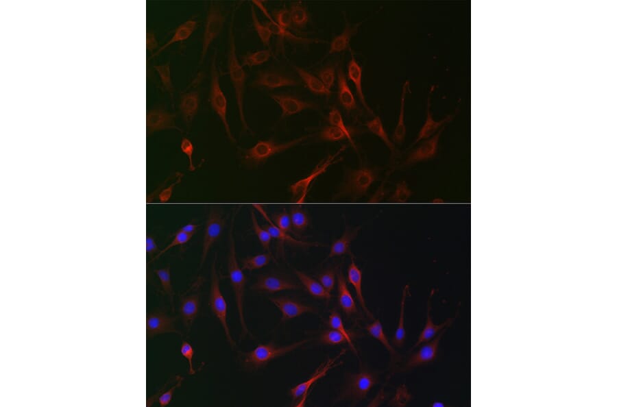 Immunofluorescence - Anti-CD130 Antibody (A92779) - Antibodies.com