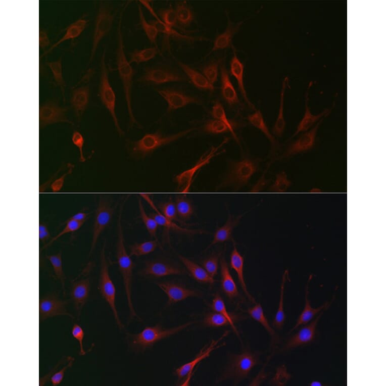 Immunofluorescence - Anti-CD130 Antibody (A92779) - Antibodies.com