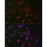 Immunofluorescence - Anti-CD130 Antibody (A92779) - Antibodies.com