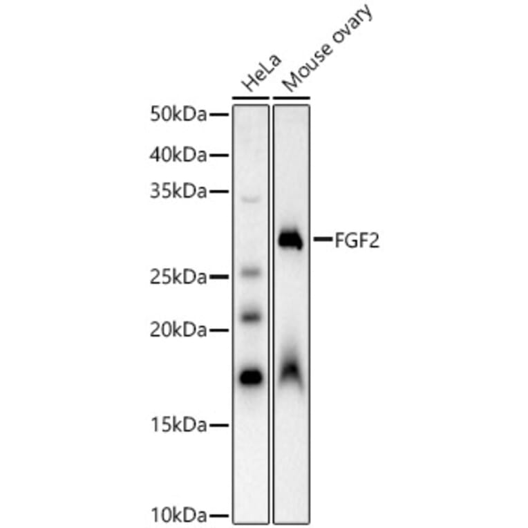 Western Blot - Anti-FGF2 Antibody (A92780) - Antibodies.com