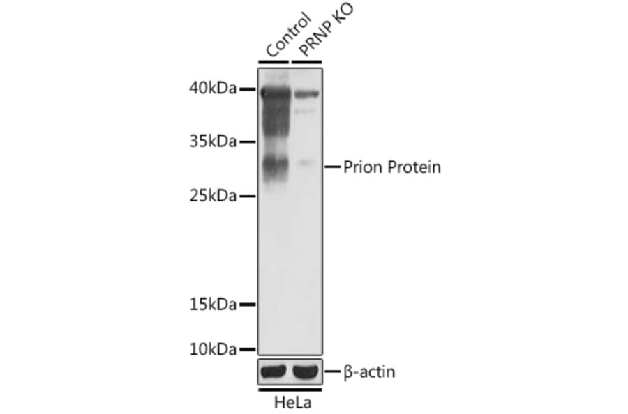Western Blot - Anti-Prion protein PrP Antibody (A92782) - Antibodies.com