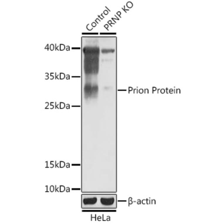 Western Blot - Anti-Prion protein PrP Antibody (A92782) - Antibodies.com