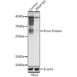Western Blot - Anti-Prion protein PrP Antibody (A92782) - Antibodies.com