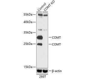Western Blot - Anti-COMT Antibody (A92783) - Antibodies.com