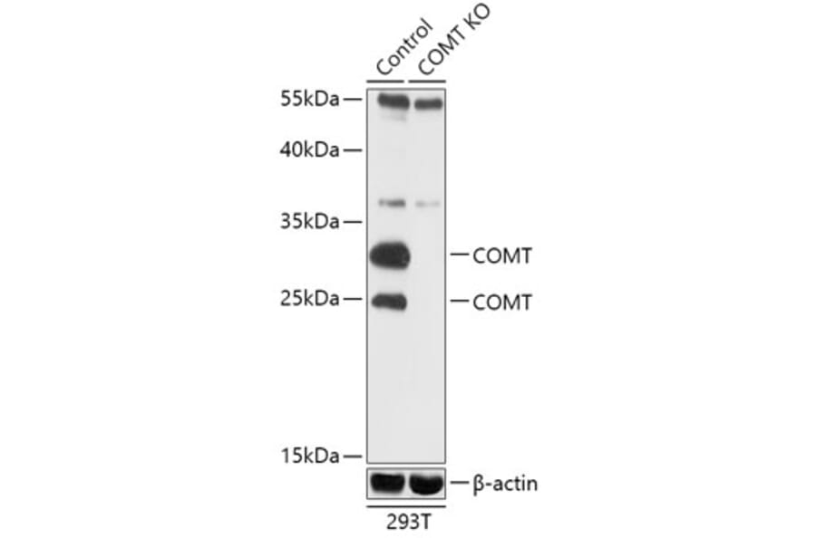 Western Blot - Anti-COMT Antibody (A92783) - Antibodies.com