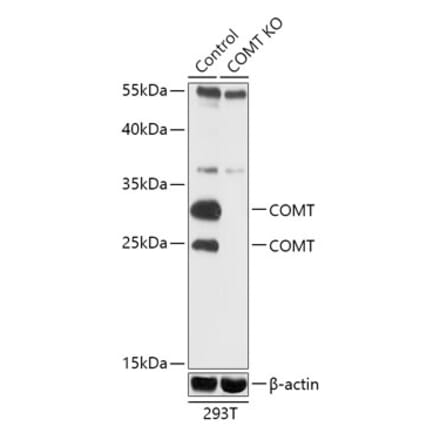 Western Blot - Anti-COMT Antibody (A92783) - Antibodies.com