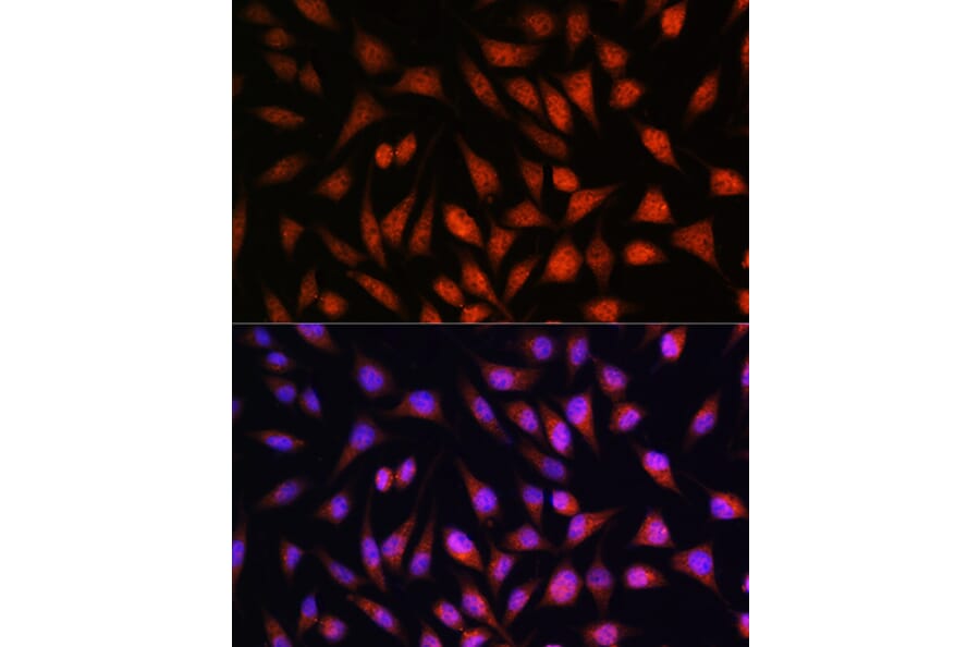 Immunofluorescence - Anti-STAT1 Antibody (A92784) - Antibodies.com