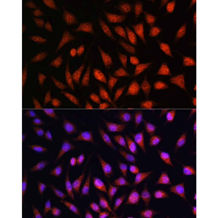 Immunofluorescence - Anti-STAT1 Antibody (A92784) - Antibodies.com