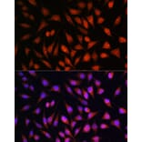 Immunofluorescence - Anti-STAT1 Antibody (A92784) - Antibodies.com