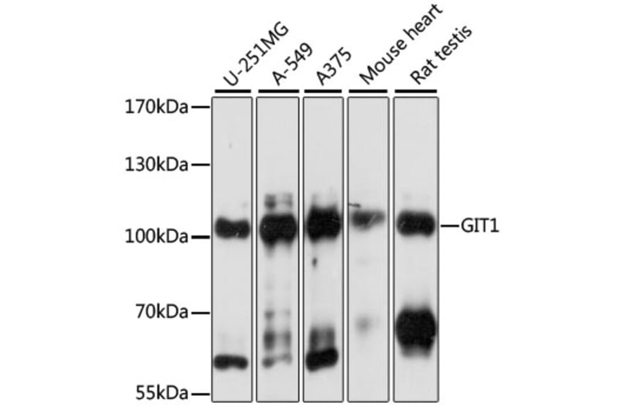 Western Blot - Anti-GIT1 Antibody (A92785) - Antibodies.com