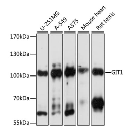 Western Blot - Anti-GIT1 Antibody (A92785) - Antibodies.com
