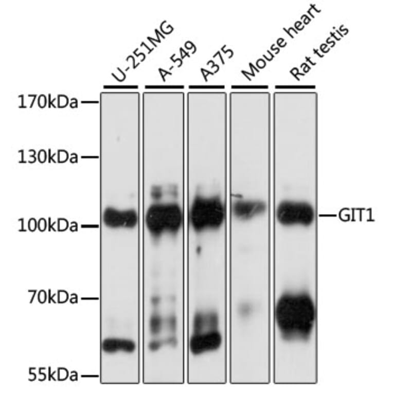 Western Blot - Anti-GIT1 Antibody (A92785) - Antibodies.com