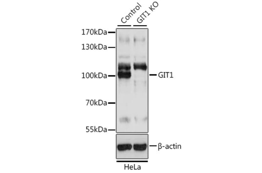 Western Blot - Anti-GIT1 Antibody (A92785) - Antibodies.com