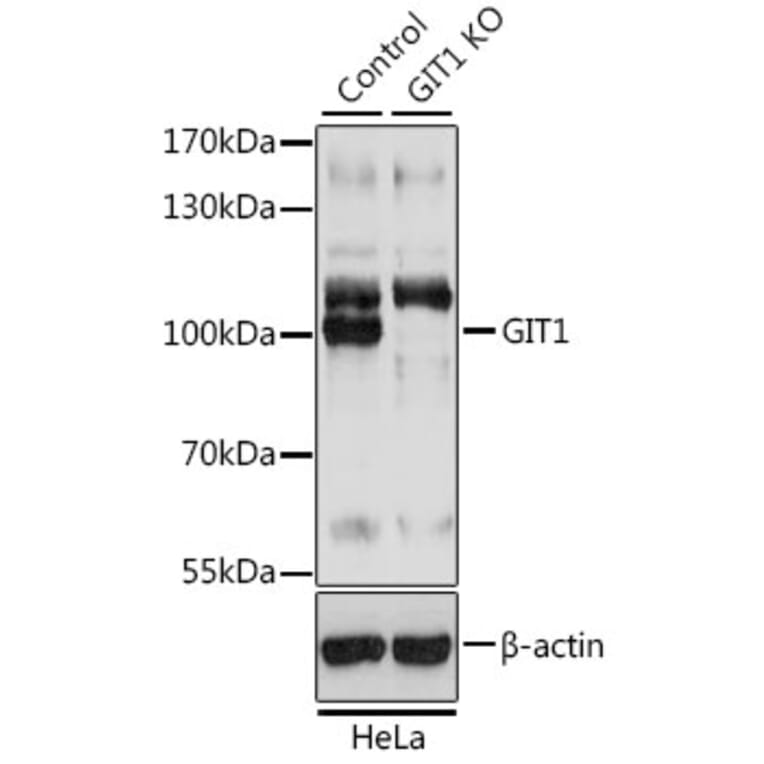 Western Blot - Anti-GIT1 Antibody (A92785) - Antibodies.com