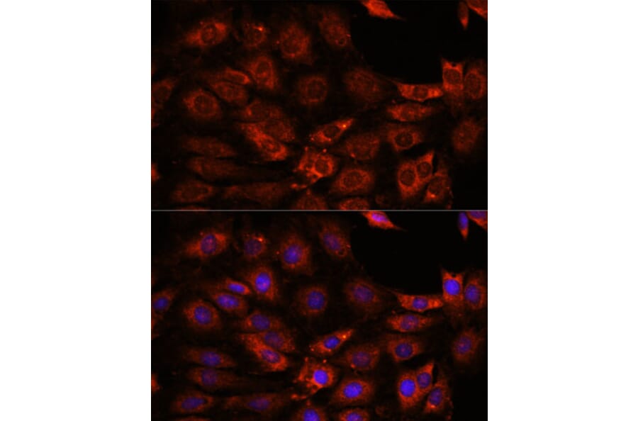 Immunofluorescence - Anti-GIT1 Antibody (A92785) - Antibodies.com