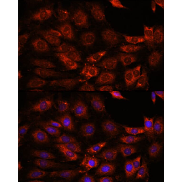 Immunofluorescence - Anti-GIT1 Antibody (A92785) - Antibodies.com