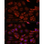 Immunofluorescence - Anti-GIT1 Antibody (A92785) - Antibodies.com