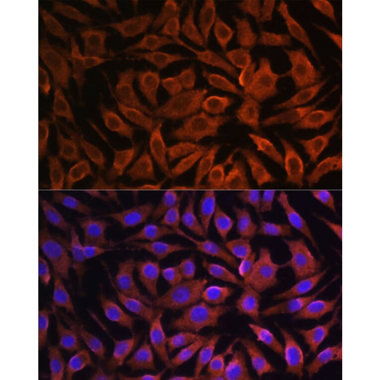 Immunofluorescence - Anti-GIT1 Antibody (A92785) - Antibodies.com