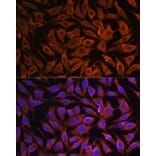 Immunofluorescence - Anti-GIT1 Antibody (A92785) - Antibodies.com