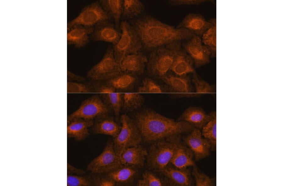 Immunofluorescence - Anti-GIT1 Antibody (A92785) - Antibodies.com