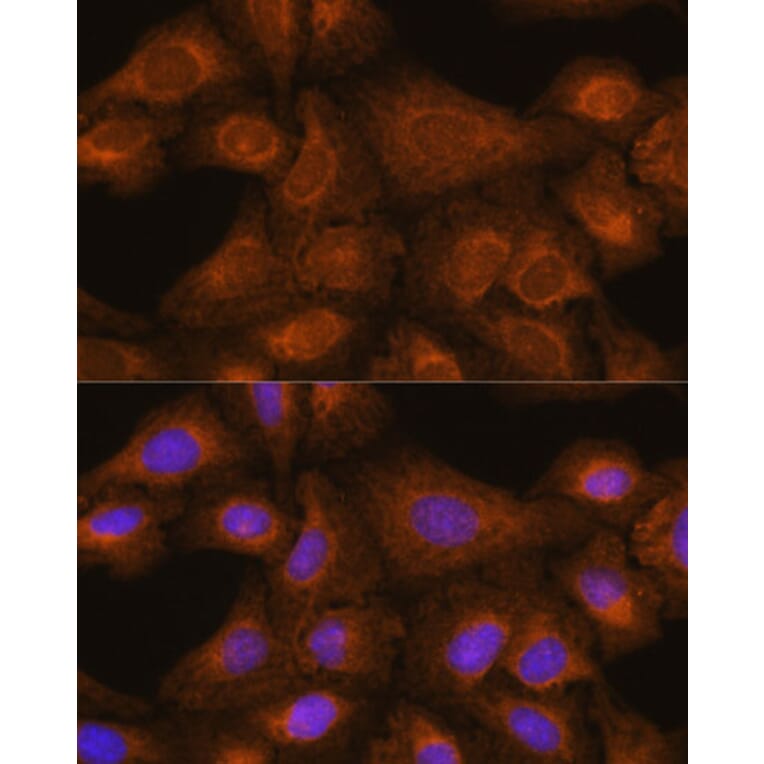 Immunofluorescence - Anti-GIT1 Antibody (A92785) - Antibodies.com