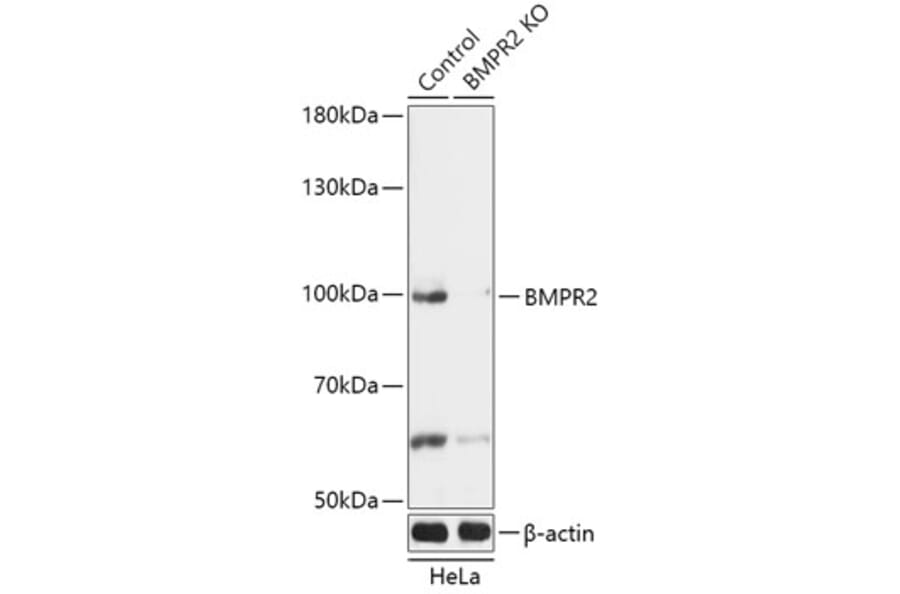 Western Blot - Anti-BMPR2 Antibody (A92786) - Antibodies.com