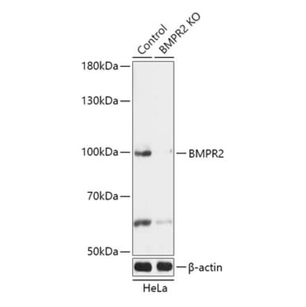 Western Blot - Anti-BMPR2 Antibody (A92786) - Antibodies.com