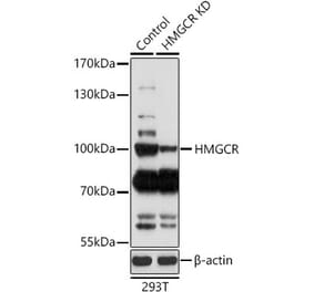 Western Blot - Anti-HMGCR Antibody (A92787) - Antibodies.com