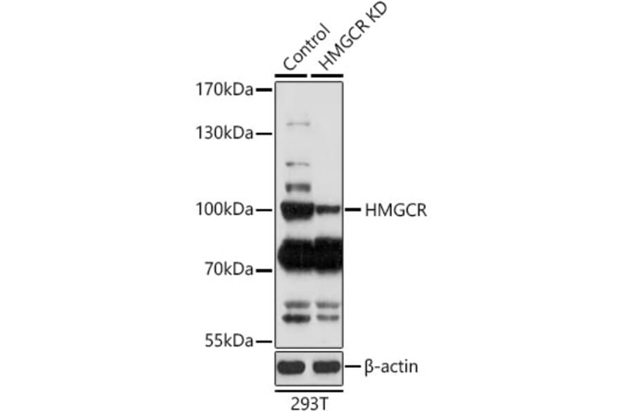 Western Blot - Anti-HMGCR Antibody (A92787) - Antibodies.com