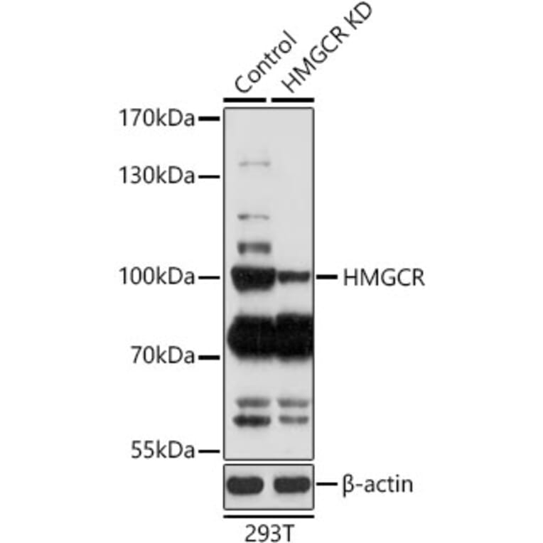 Western Blot - Anti-HMGCR Antibody (A92787) - Antibodies.com