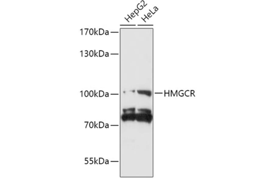 Western Blot - Anti-HMGCR Antibody (A92787) - Antibodies.com