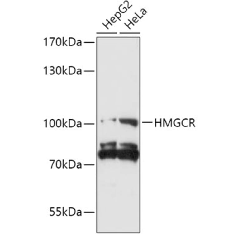 Western Blot - Anti-HMGCR Antibody (A92787) - Antibodies.com